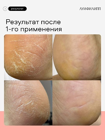 Пилинг для кожи стоп LUI PHILIPP COSMETICS Foot peeling, 100 мл (М)